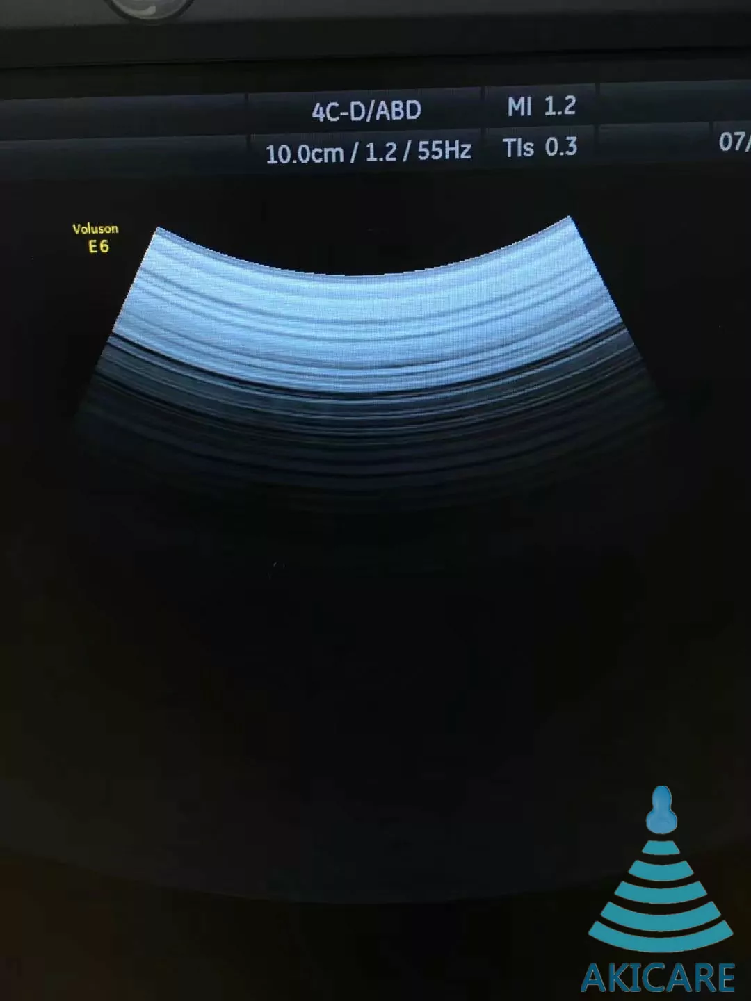 4C-D Ultrasound Probe Repair — for GE Voluson E6