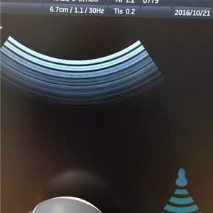 RAB2-5-D For GE Voluson E8 3D/4D CONVEX Transducer Ultrasonido Ultrasonic Sensor Ultrasound Probe REPAIR SERVICE Akicare