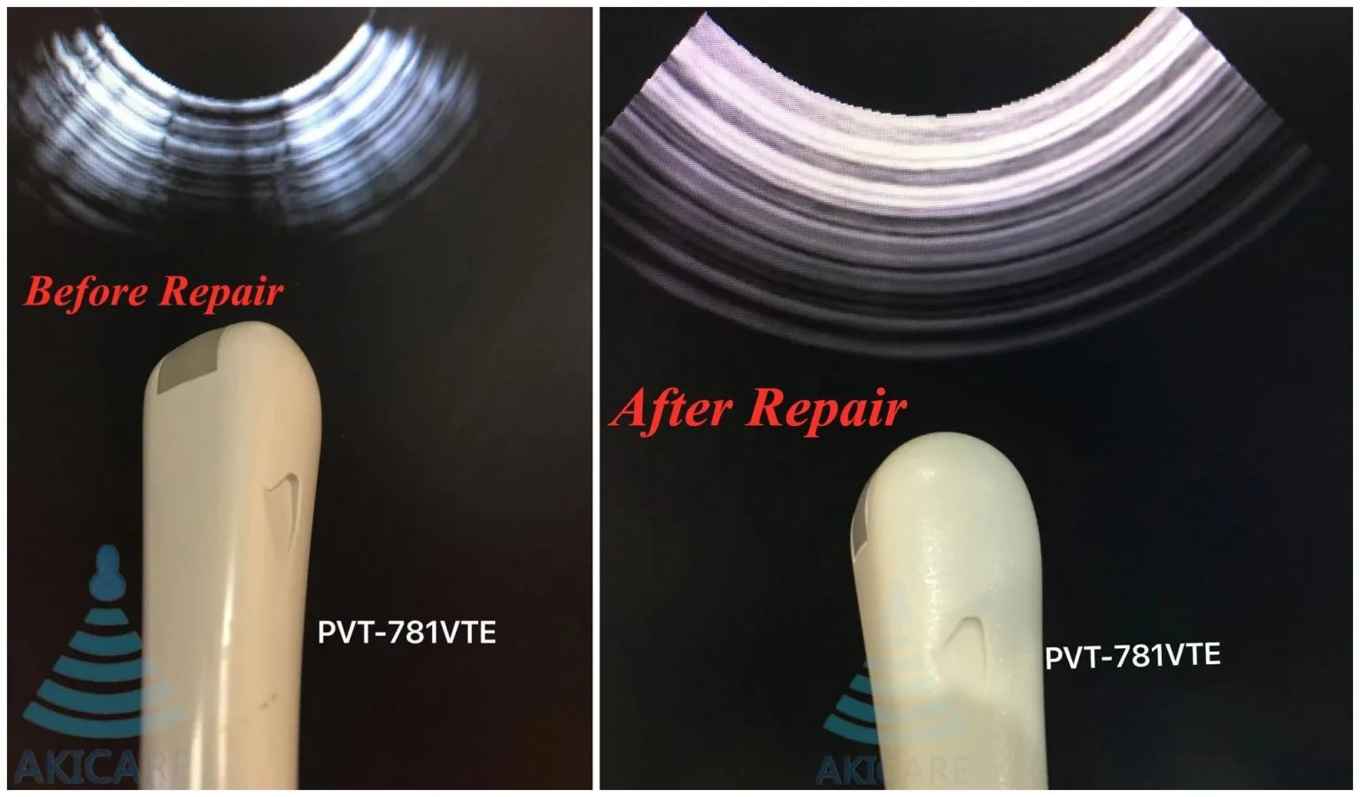 PVT-781VTE Ultrasound Probe Repair — for Toshiba Aplio 300