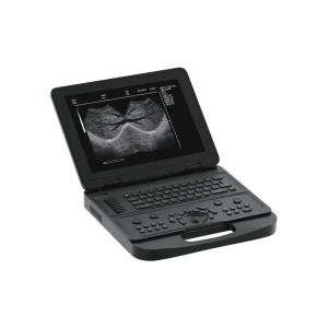 Akicare cUT10A portable ultrasound imaging system