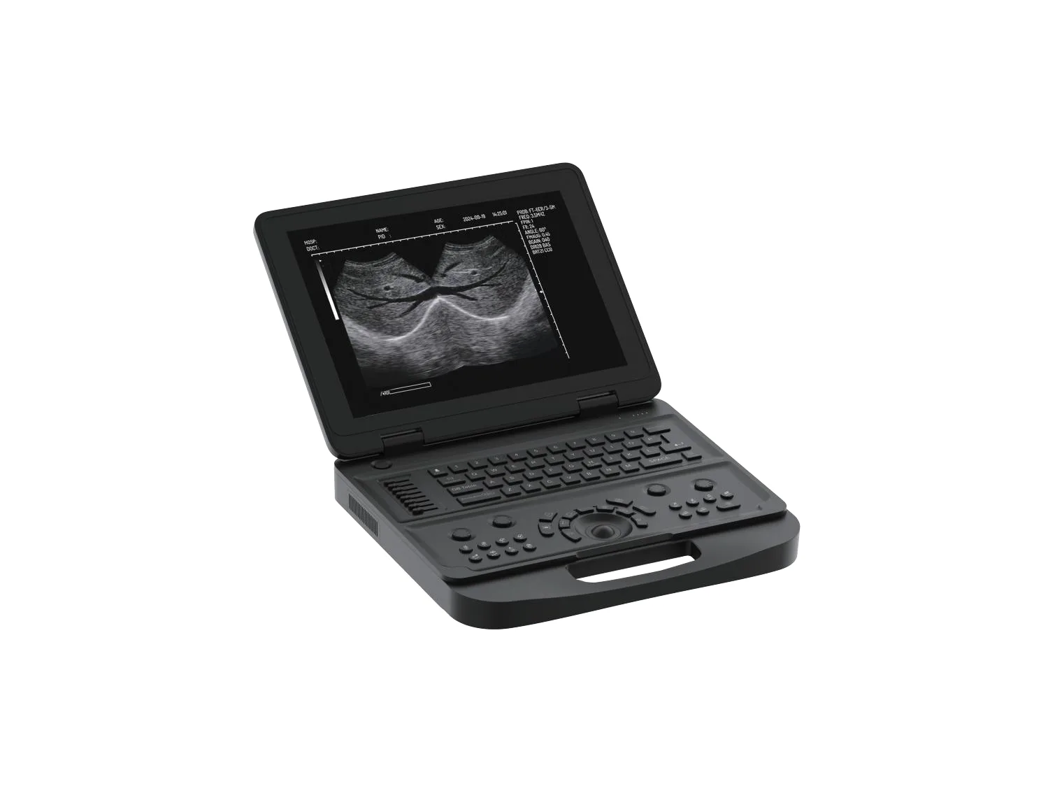 Akicare cUT10A portable ultrasound imaging system