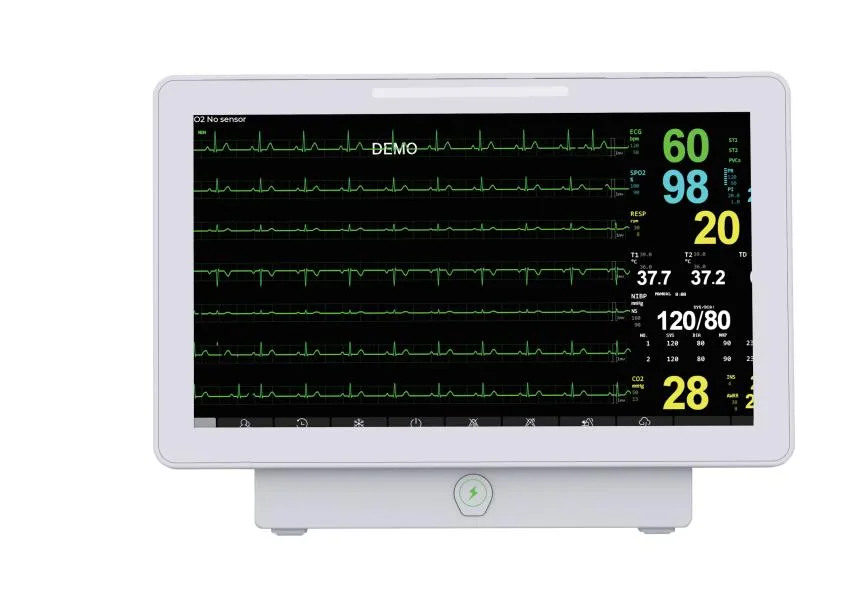 Akicare ePM multi-parameter patient monitor - view 2