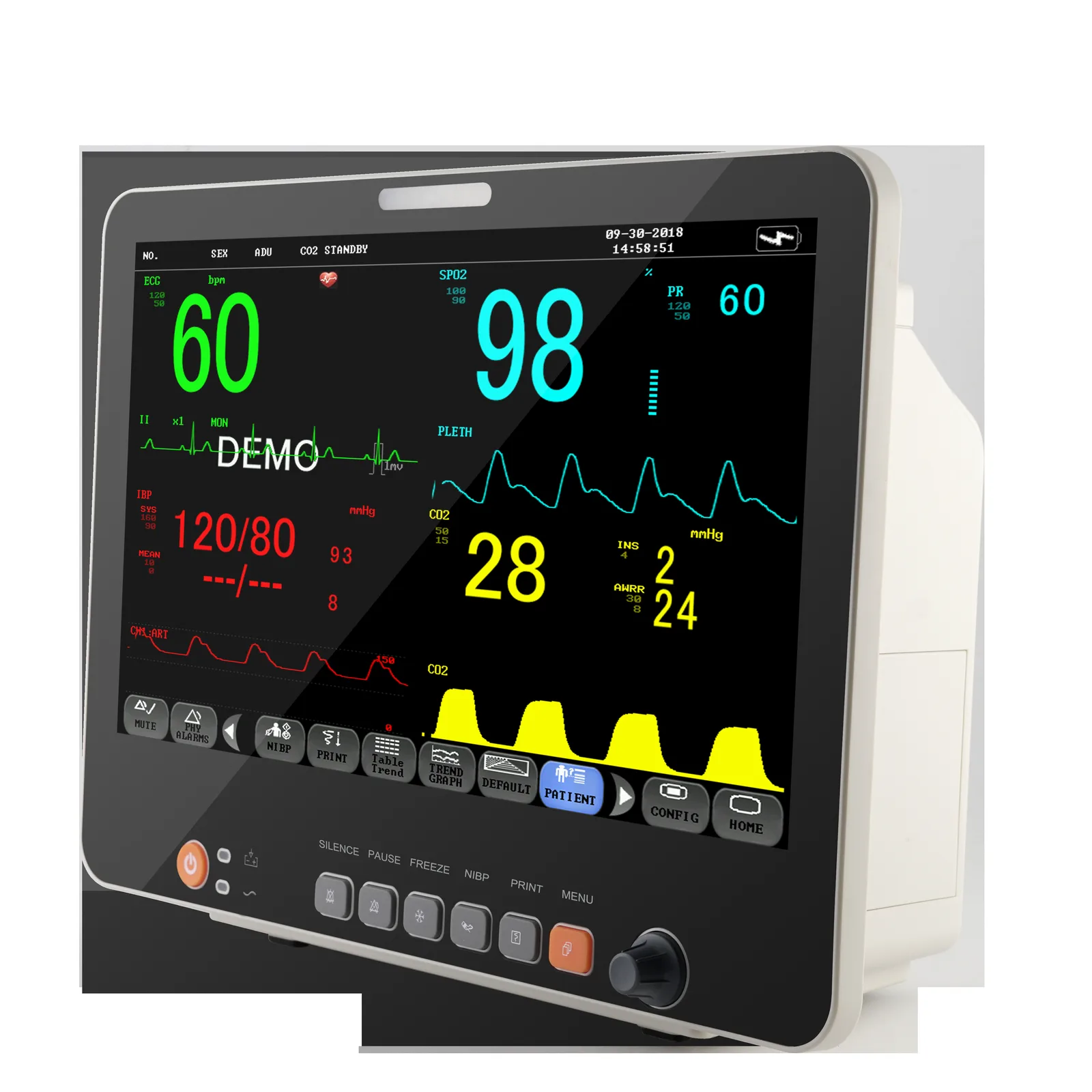 Akicare PM15B multi-parameter patient monitor - view 2