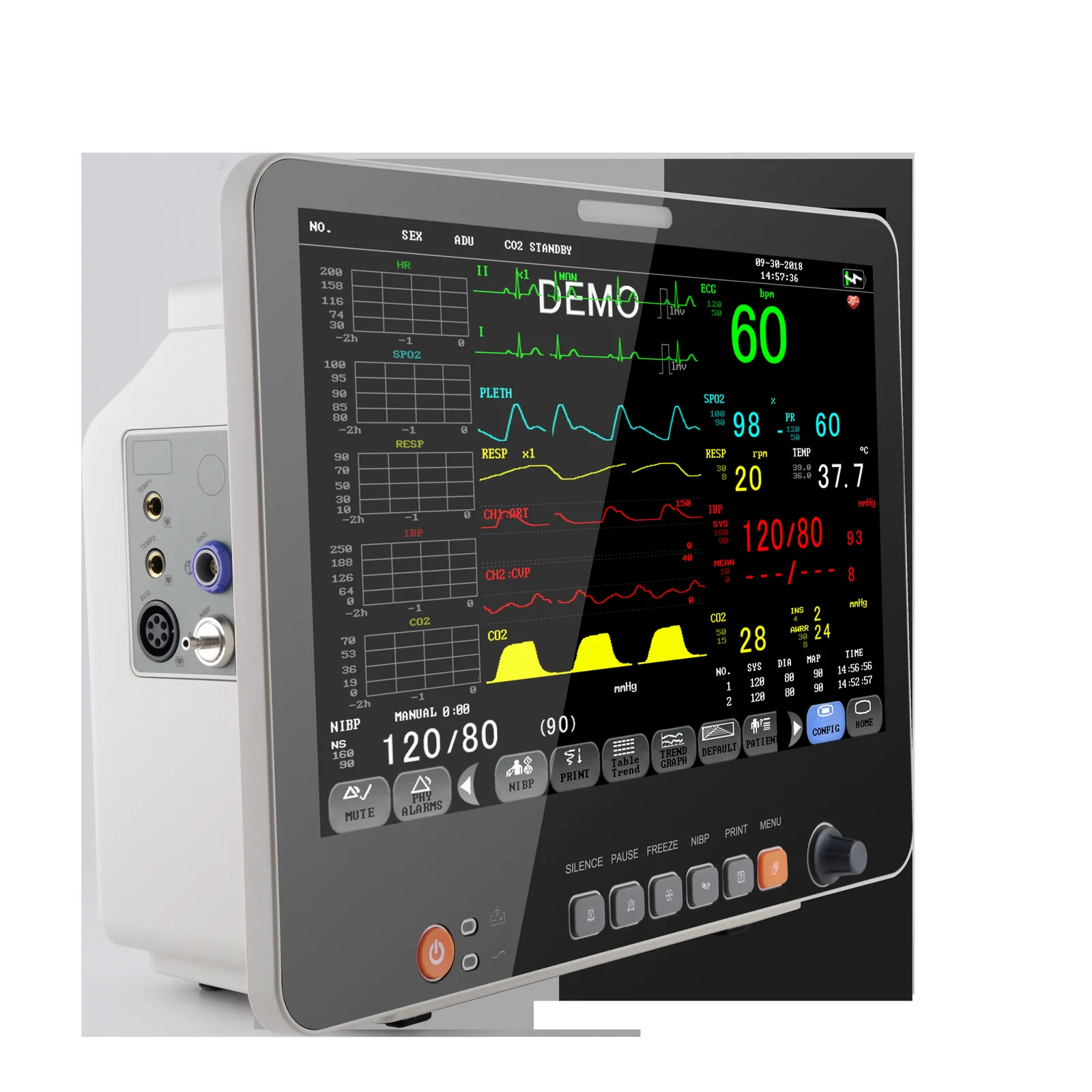 Akicare PM15B multi-parameter patient monitor - view 4